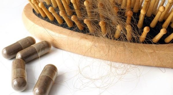 دلایل ریزش مو در زنان